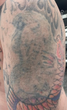 Case Review PicoAlex After