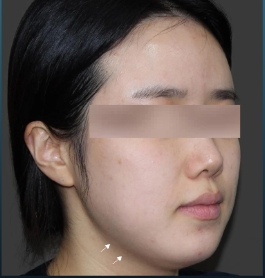 Case Review Oligio Before