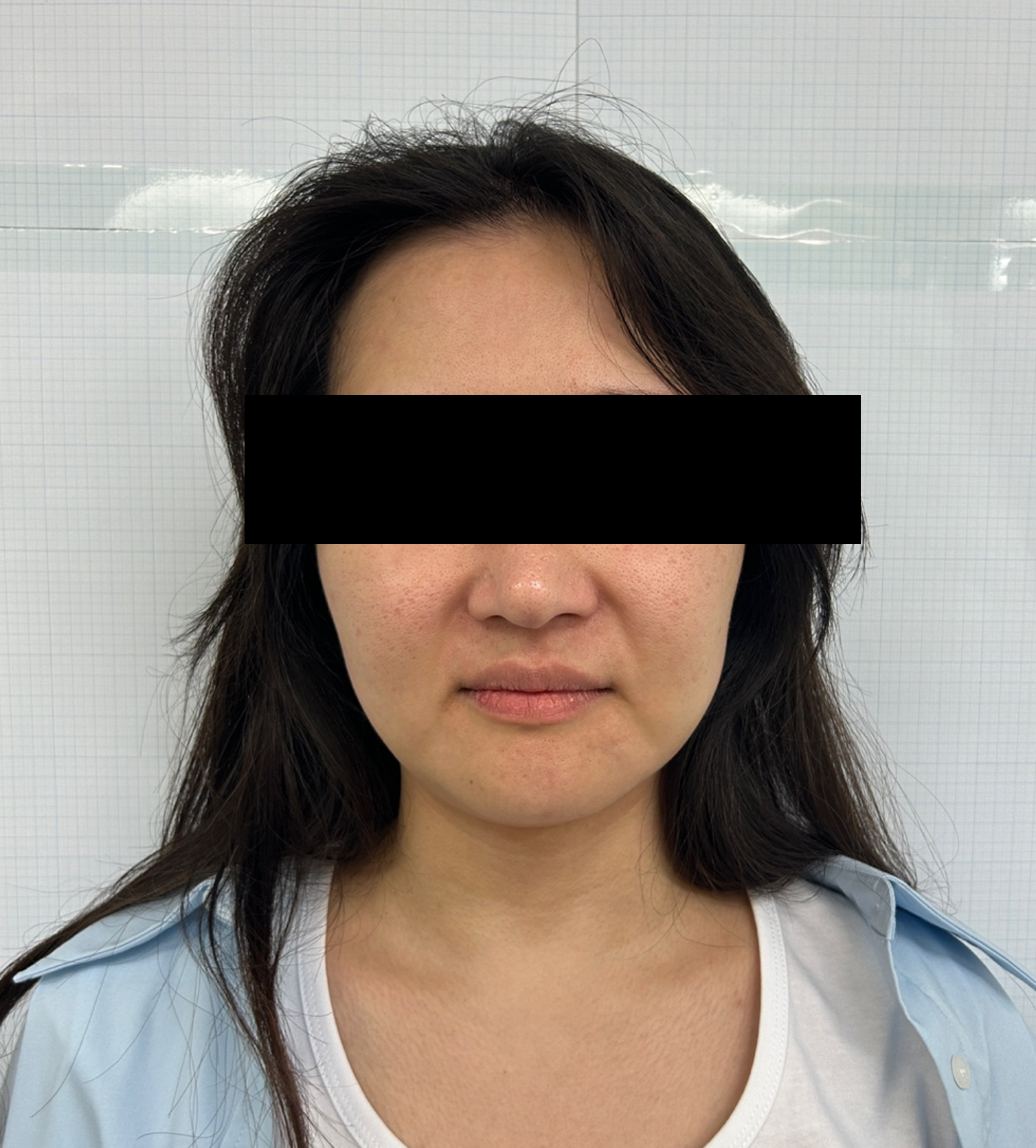 Case Review Oligio Before