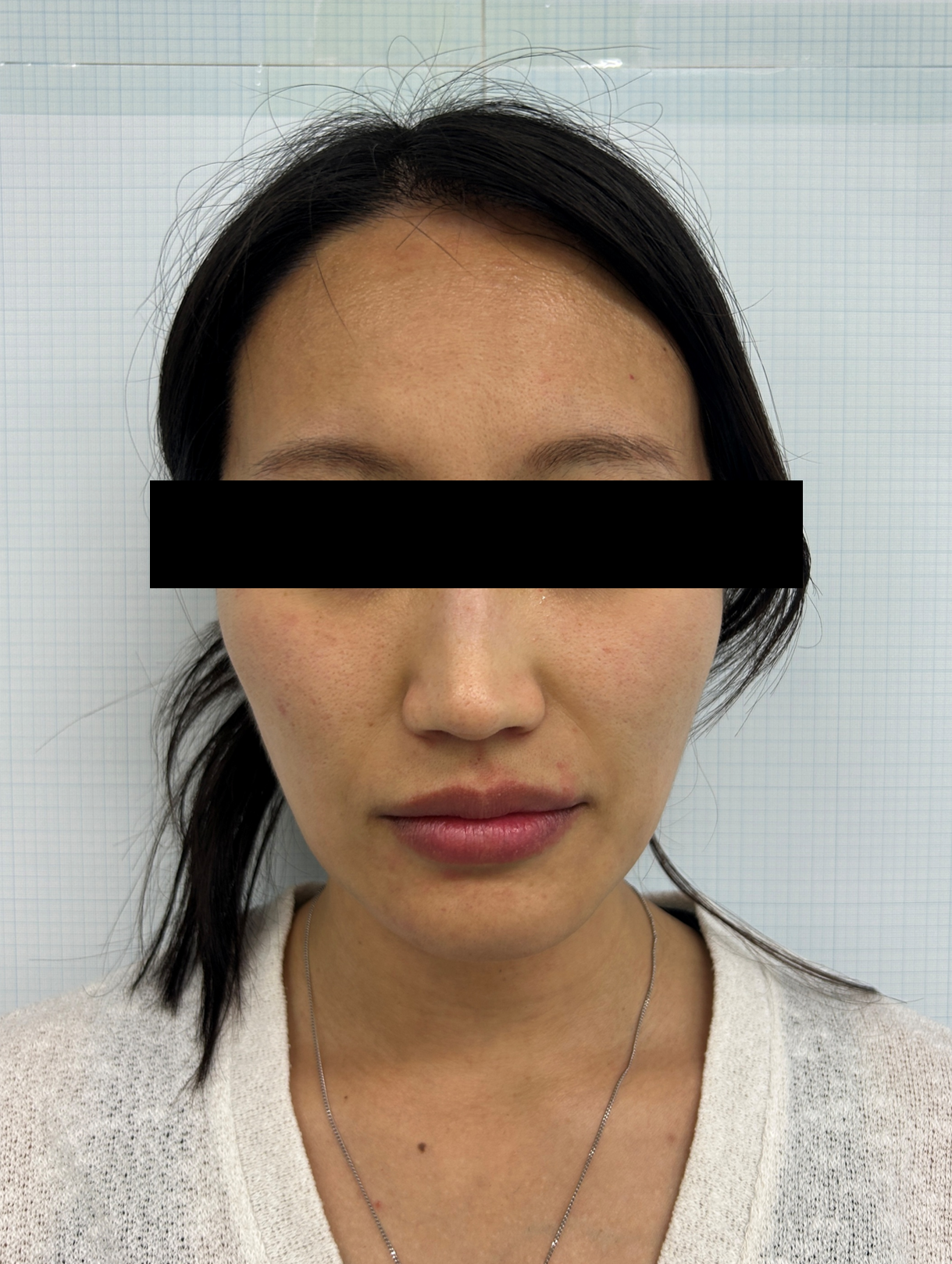 Case Review Oligio Before