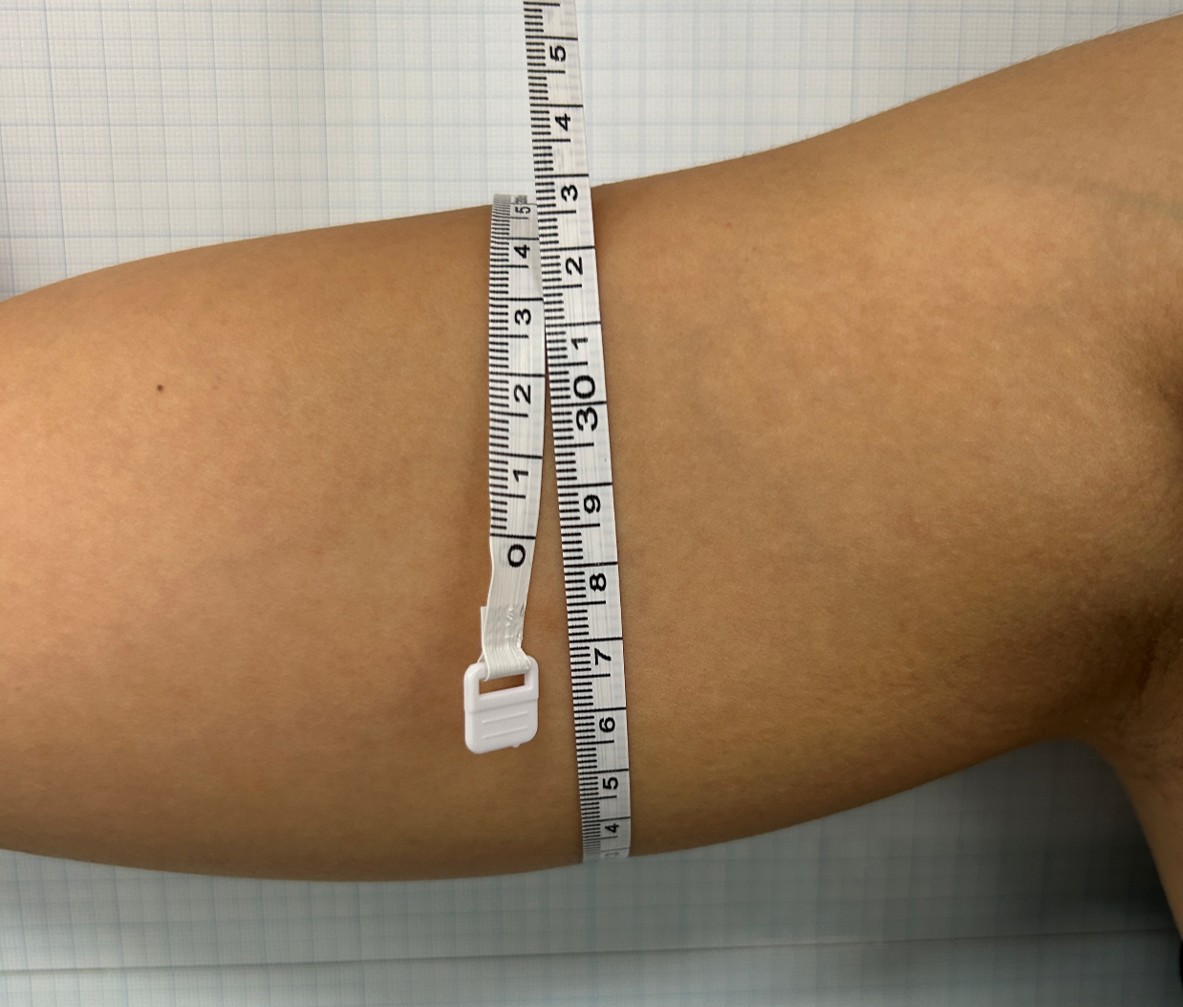 Case Review Oligio Before