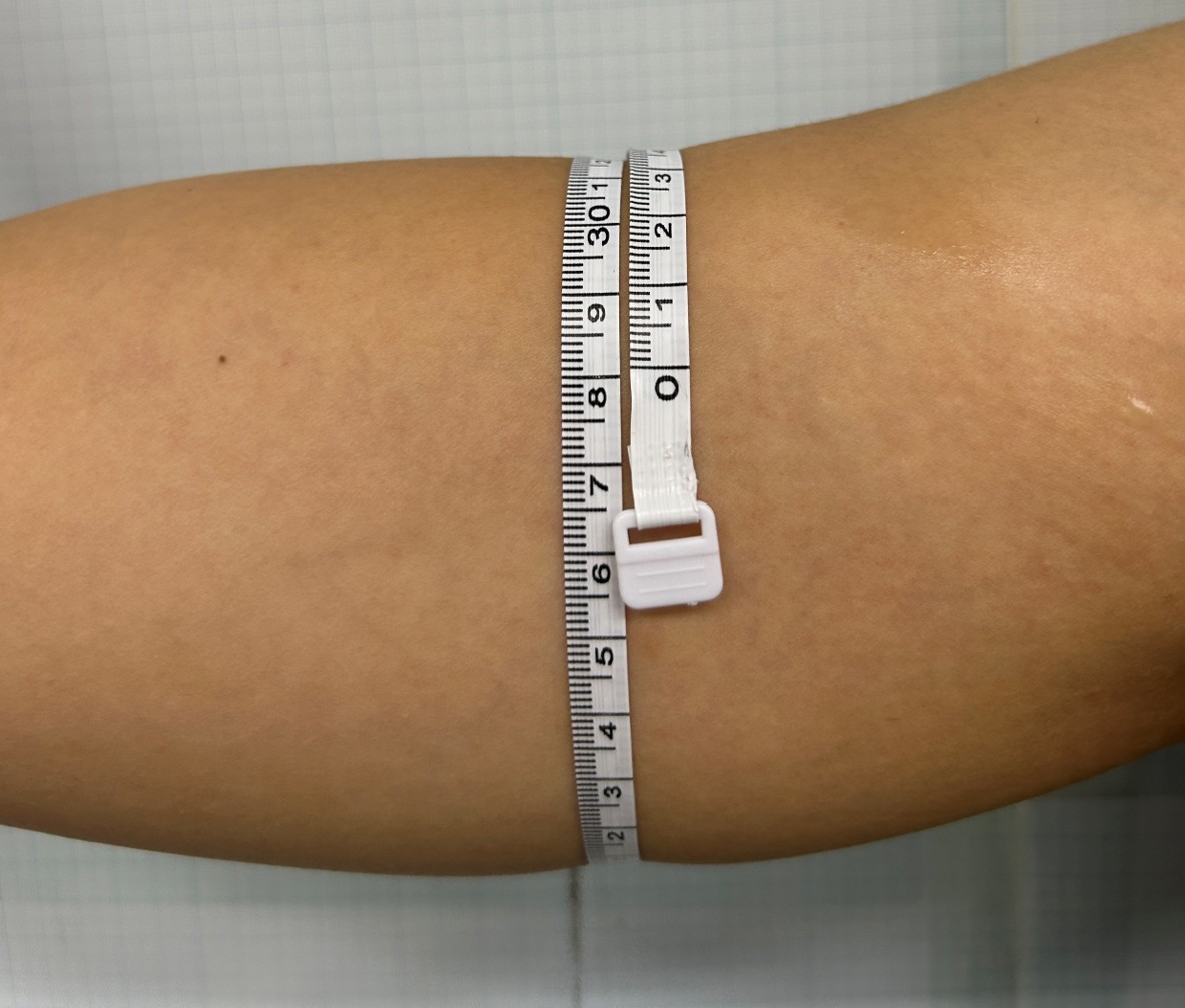 Case Review Oligio Immediately after