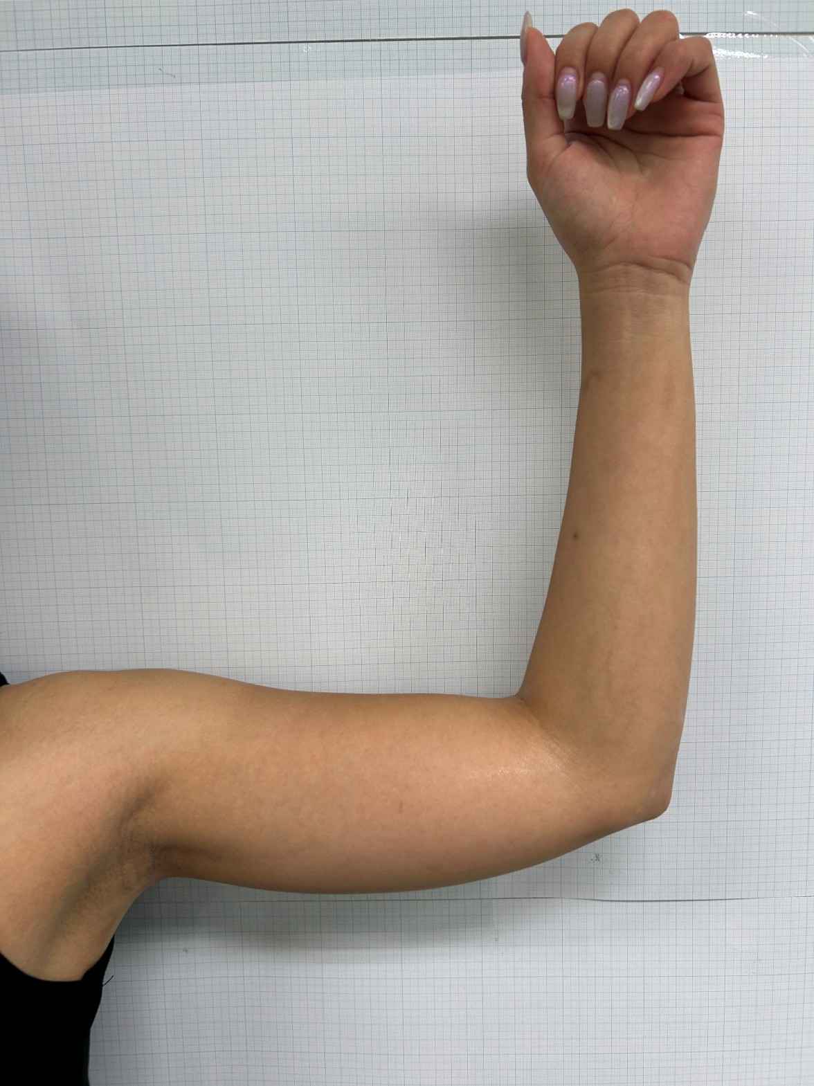 Case Review Oligio Immediately after