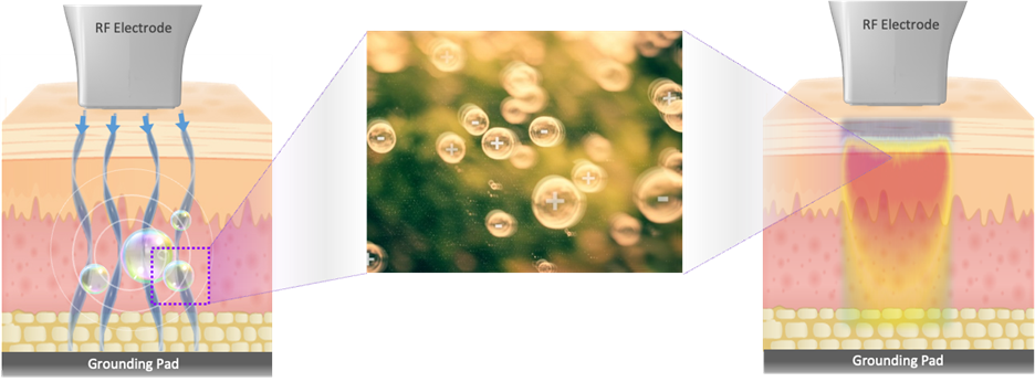 Oligio เหมาะกับใคร