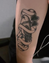 Case Review PicoAlex Before