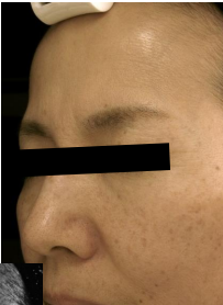 Case Review PicoAlex