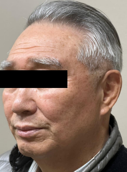 Case Review PicoAlex