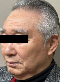 Case Review PicoAlex