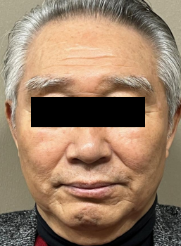 Case Review PicoAlex