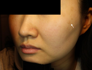 Case Review PicoAlex