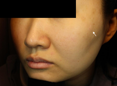 Case Review PicoAlex