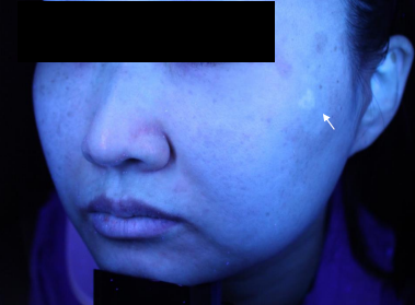 Case Review PicoAlex