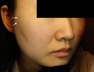 Case Review PicoAlex