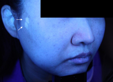 Case Review PicoAlex