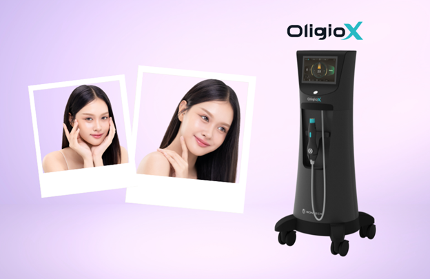 จุดเด่นของ Oligio X