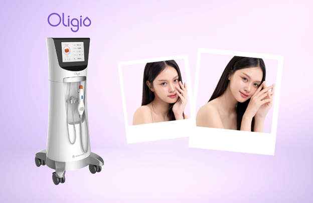 Oligio ต่างจากเครื่องยกกระชับรุ่นอื่นยังไง ทำไมถึงได้รับความนิยม